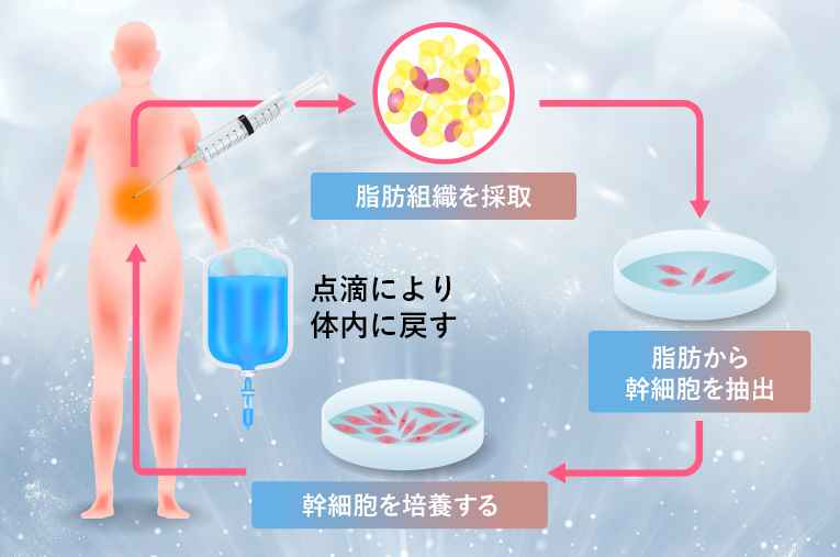 変形性腰椎症に再生医療という新しい治療方法